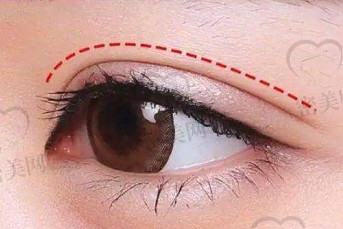 真人实例对比参考表