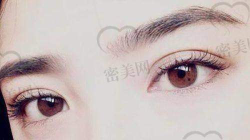 上海华美医疗美容 胡小清医生：特色无痕缝合，主打快速修复