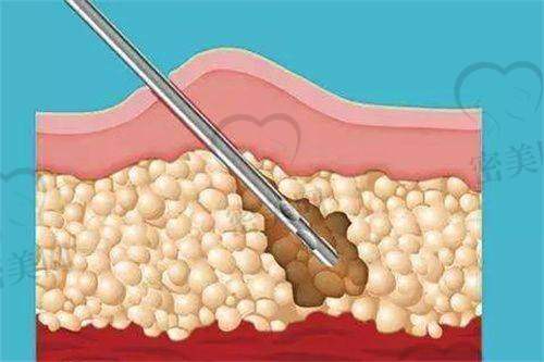 小建议:别只比价格,那不是买衣服