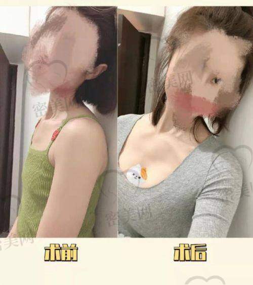 广西爱思特整形医院做儿童耳畸形整形靠谱吗?