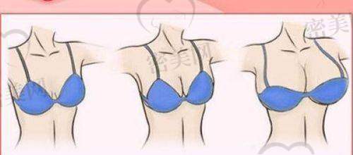 广西爱思特整形医院环境怎么样?比酒店还舒服?