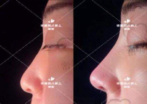 广西爱思特的材料和设备靠谱不?注射类安心吗?