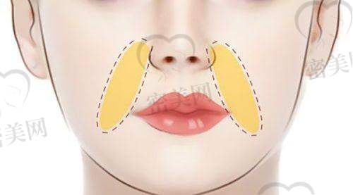 南方医 科 大学南方医院整形科技术水平怎么样?