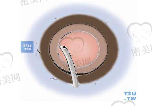 光谷爱尔眼科医院（也称洪山区分院）