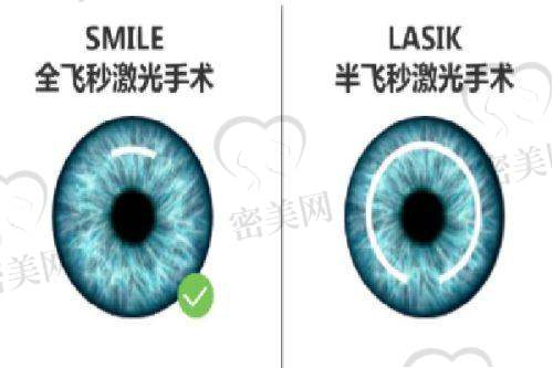 乌鲁木齐普瑞眼科医院配镜流程清单，搞清步骤更安心