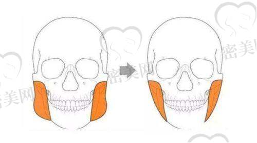 南方医 科 大学南方医院整形科怎么去?在哪里?