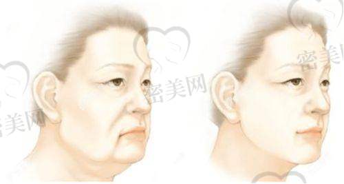 南方医 科 大学南方医院整形科有哪些服务优势?