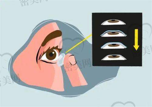 北京同仁医院西区眼科：眼底病与眼整形优选，特发性眼病诊断中 心之一