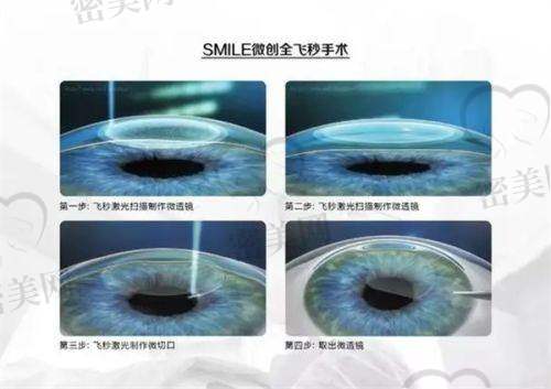 为什么建议在乌鲁木齐普瑞眼科医院配镜？