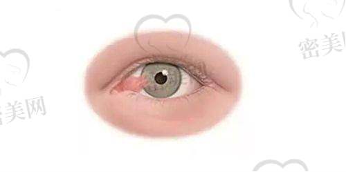 兰州爱尔眼科医院实力和医生团队情况