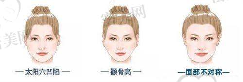 滨城曦朵医疗美容门诊部价格表: