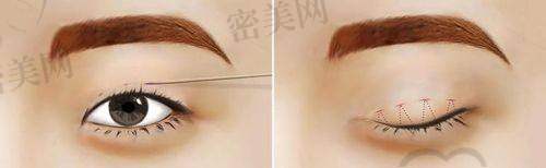 哈尔滨钟医生医疗美容门诊部口碑怎么样?