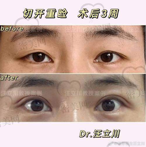 上海伯思立医疗美容 徐晓斐医生：女性视角+术后跟踪，全流程贴心