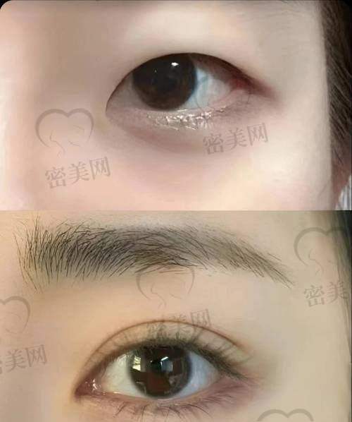 哈尔滨钟医生医疗美容门诊部特色项目: