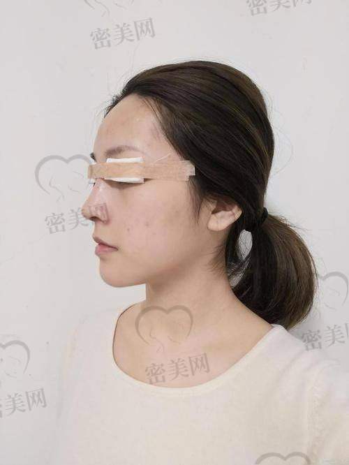 上海伯思立医疗美容 沈国雄医生：追求自然过渡，适合高阶审美