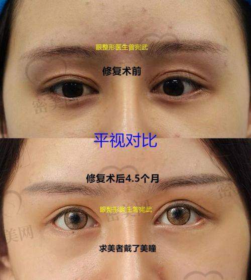 上海华美医疗美容 陈小剑医生：功能兼美观，主攻术后功能障碍