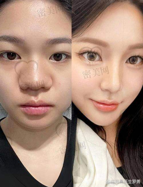 广西爱思特整形医院值不值得去?医院资质曝光!