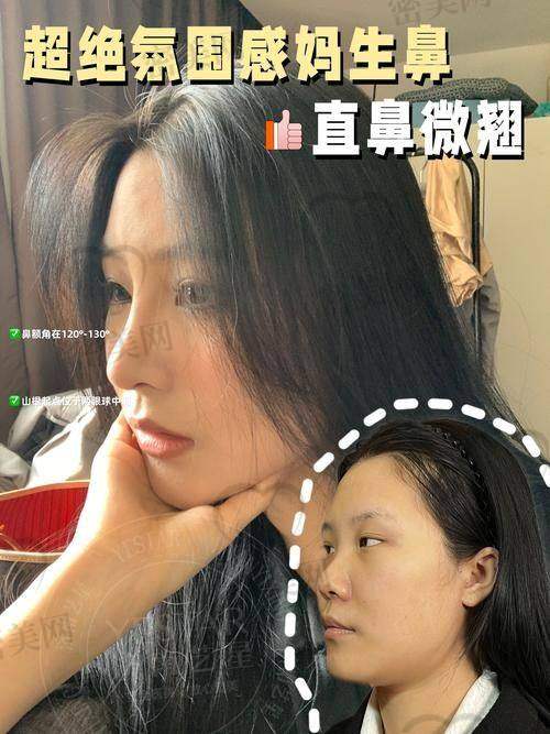 成都新华医院(国有) 肖凌医生:感染类修复鼻整形老手