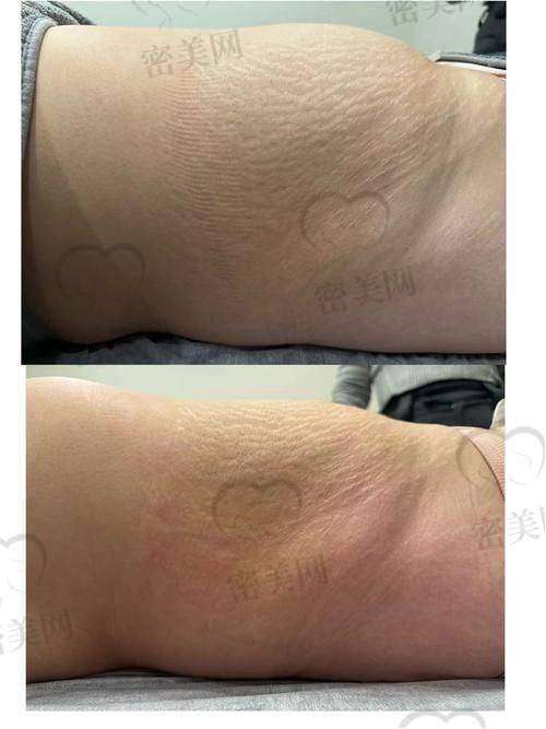 “值不值”不是看价格,是要看线条值不值得被雕