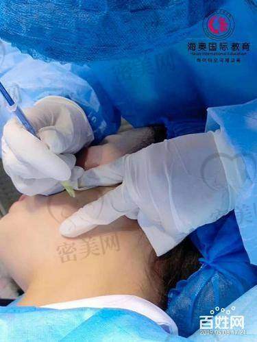 选择Ellanse不是冲动而是“理智省钱”的选择