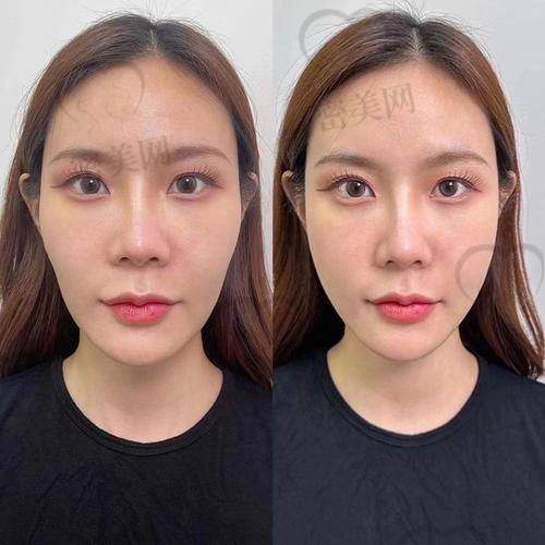 【邓小青医生简介】