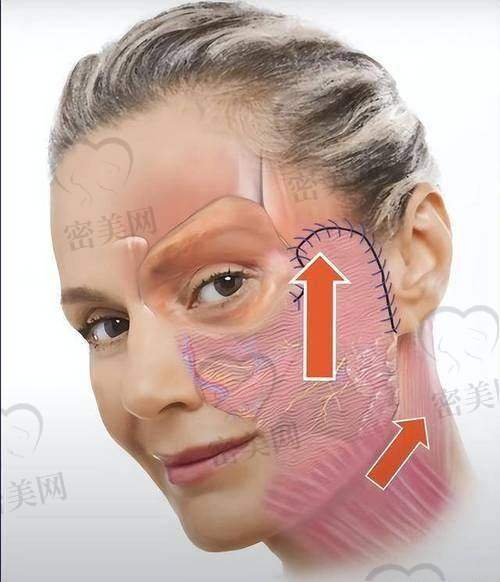 北京蒂凡妮医疗美容王志坚面部拉皮提升 4 万起,开启抗衰新体验!