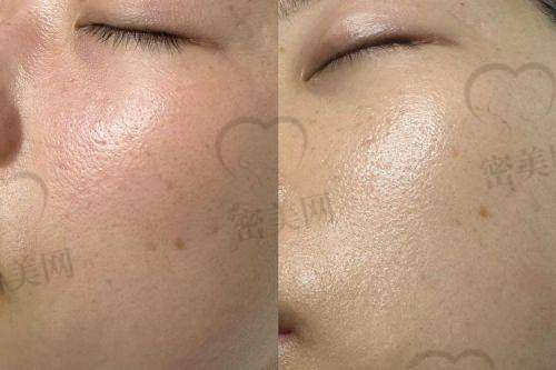 岳阳禾美荟整形：医院实力大揭秘