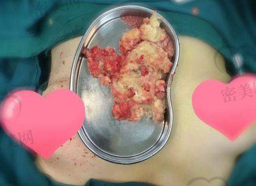 广州荔湾医院清奥预约方式分享:合理规划就诊时间,避免排长队