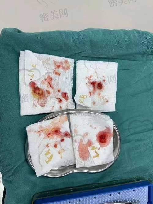 这些症状,你中了几条?