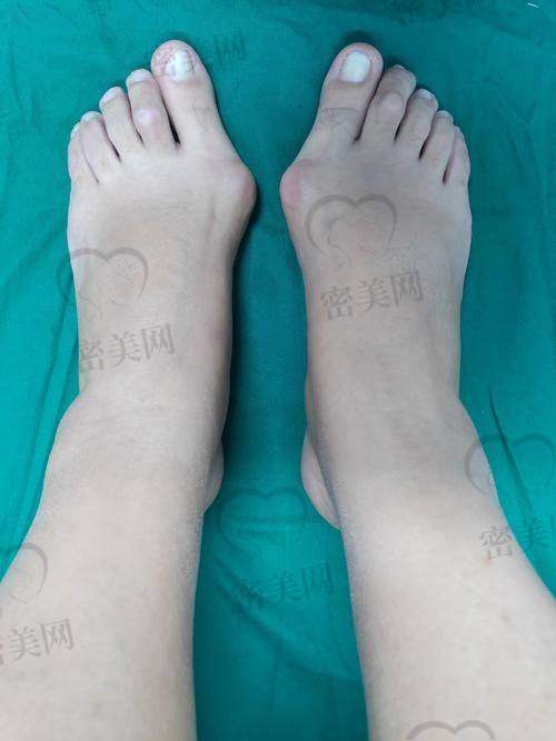 术前术后流程规范,修复期安心放心!