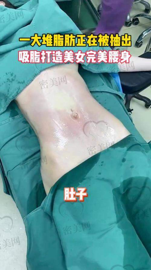 孙波医生擅长项目: