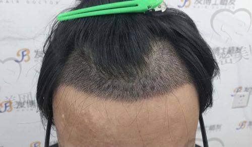 术后服务与修复管理怎么样？有没有跟踪护理？