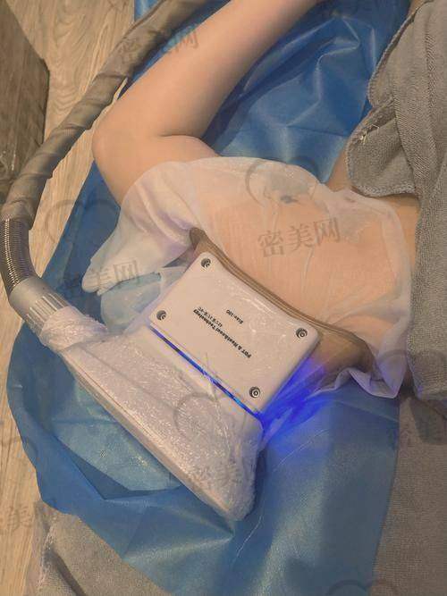 北京京民医院医疗美容科:快速出脂,术后修复快