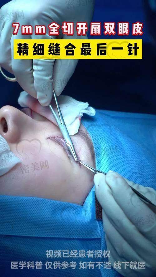 上海爱尚丽格医疗 杜园园医生：多层解构技术，让肉条感无处遁形